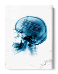 Xray Money