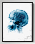 Xray Money