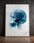 Xray Money