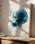 Xray Money